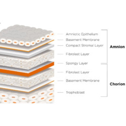 AMNIOTIC MENBRANE "PATCHES"