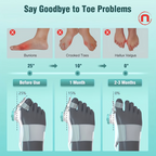 Adjustable Metatarsal Support Device for Men and Women