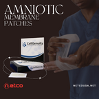 AMNIOTIC MEMBRANE "PATCHES"
