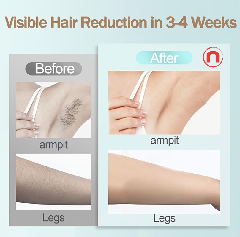 IPL Hair Removal Device for Women and Men