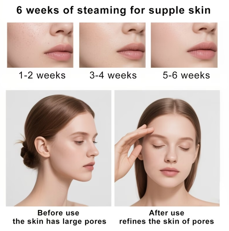 LEFINEE Facial Steamer with Fine Mist Technology ✨💆‍♀️💨